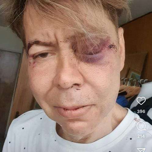 Murió diseñador luego de recibir golpiza