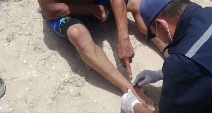 Lanzan alerta por picaduras de Raya en el Lago de Maracaibo