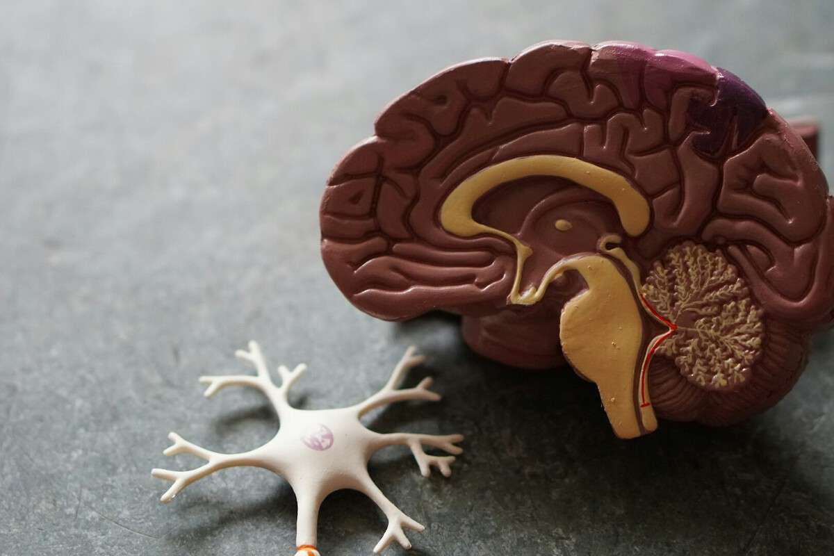 El Alzheimer ya no parece irreversible
